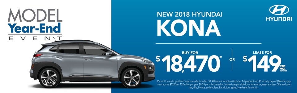 Buy or Lease 2018 Kona