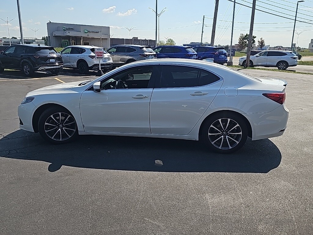 2016 Acura TLX SH-AWD Advance photo 3