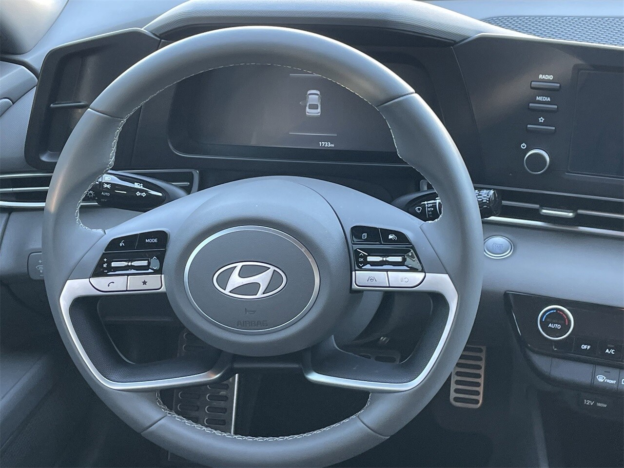 2025 Hyundai Elantra SEL Sport photo 3