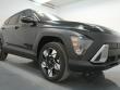 New 2025 Hyundai Kona SEL Convenience SUV