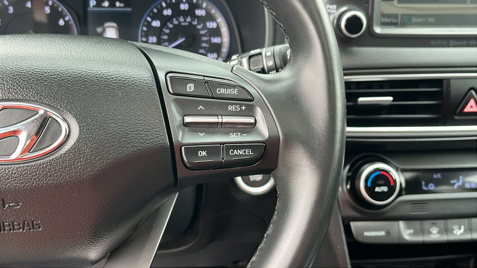 2018 Hyundai Kona Ultimate - Photo 13