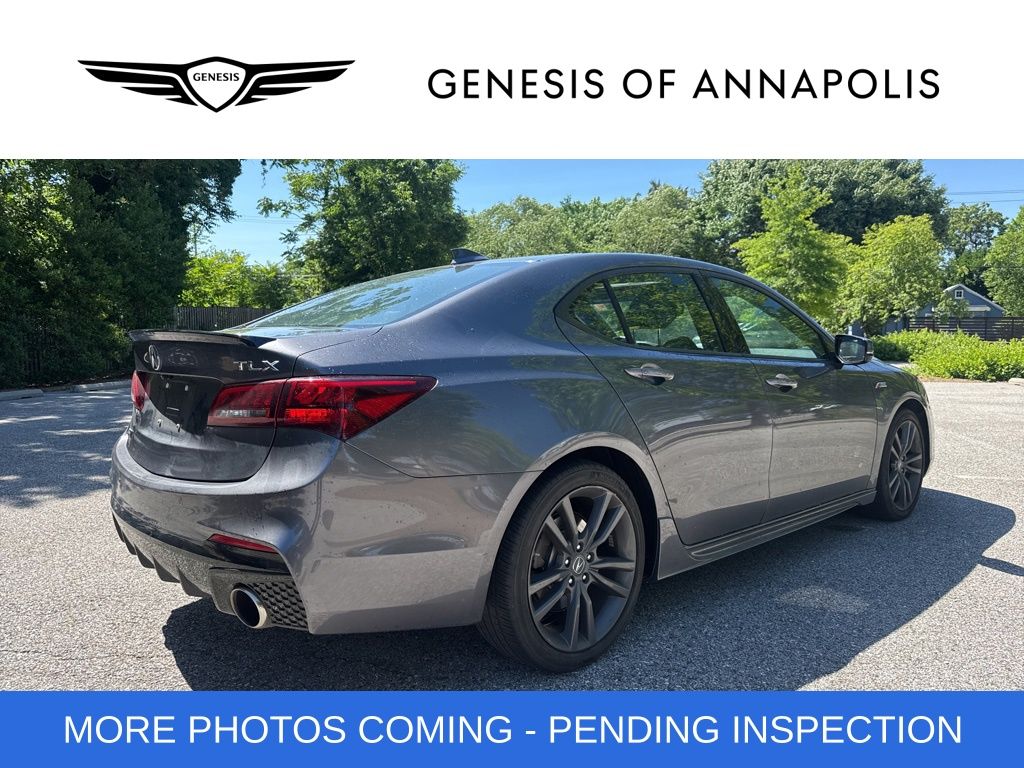 2019 Acura TLX Technology & A-Spec Pack RED - Photo 5
