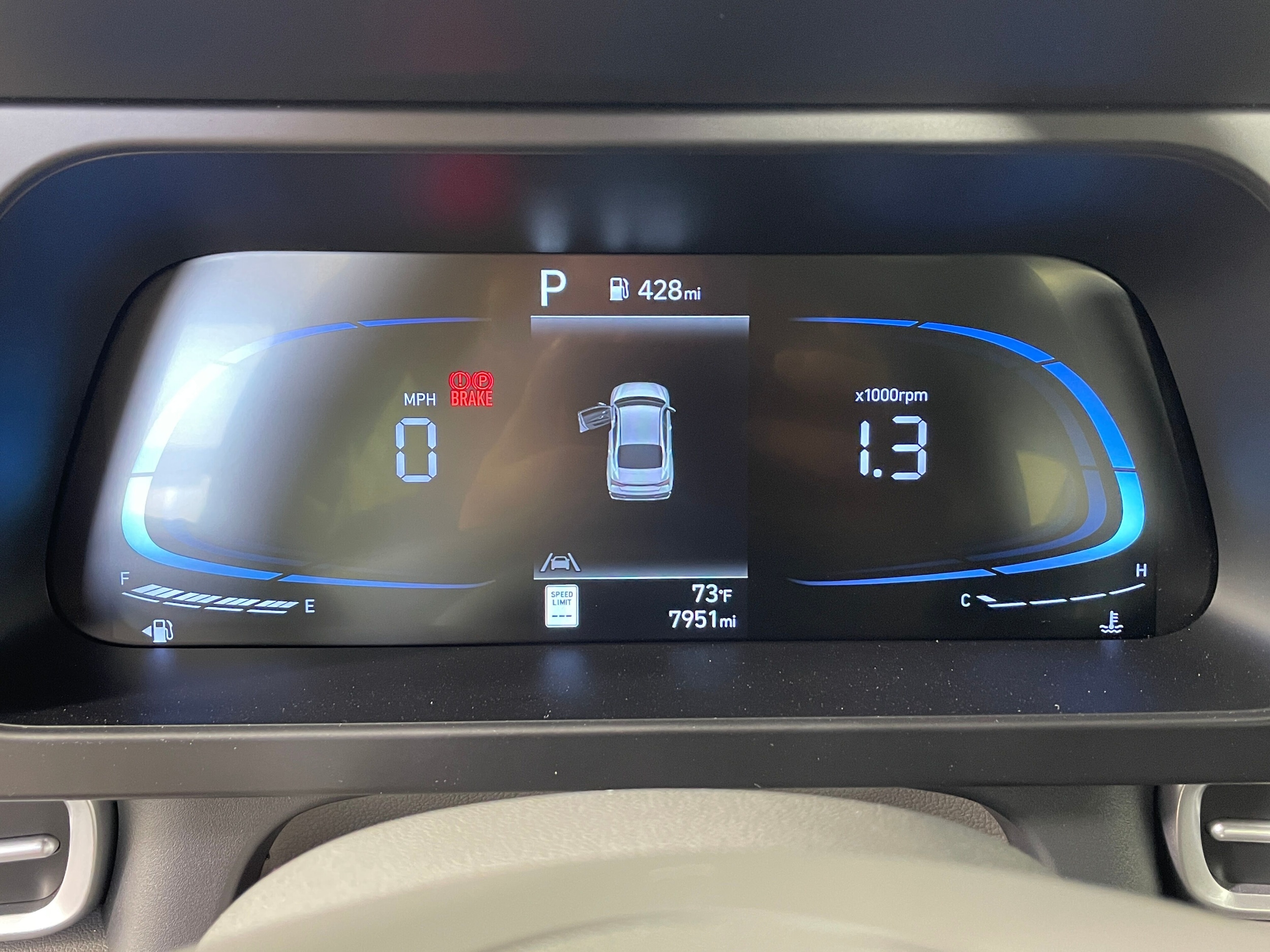 2025 Hyundai Elantra SE photo 4