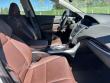 2016 Acura TLX V6 (A9) Sedan