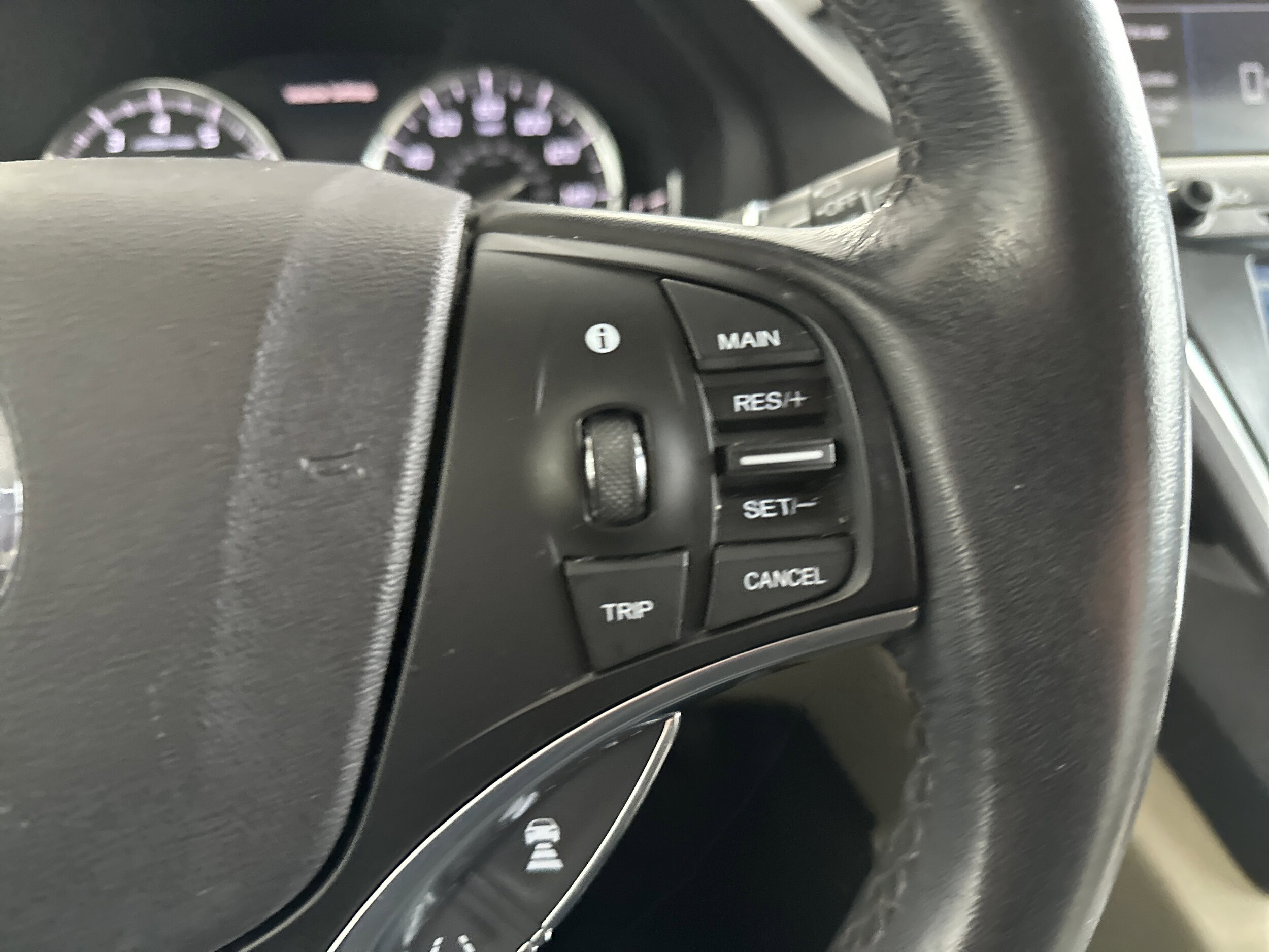 2018 Acura MDX photo 2