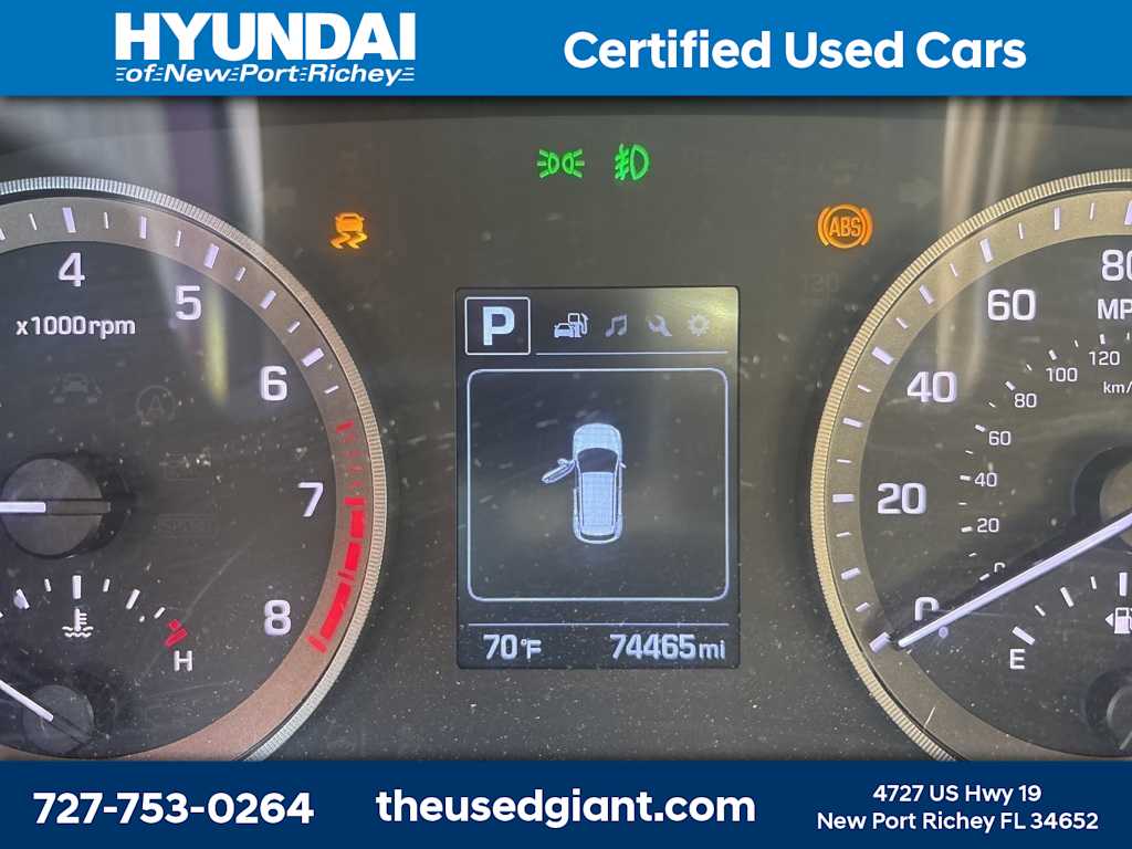 Thumbnail: 2017 Hyundai Tucson - 11