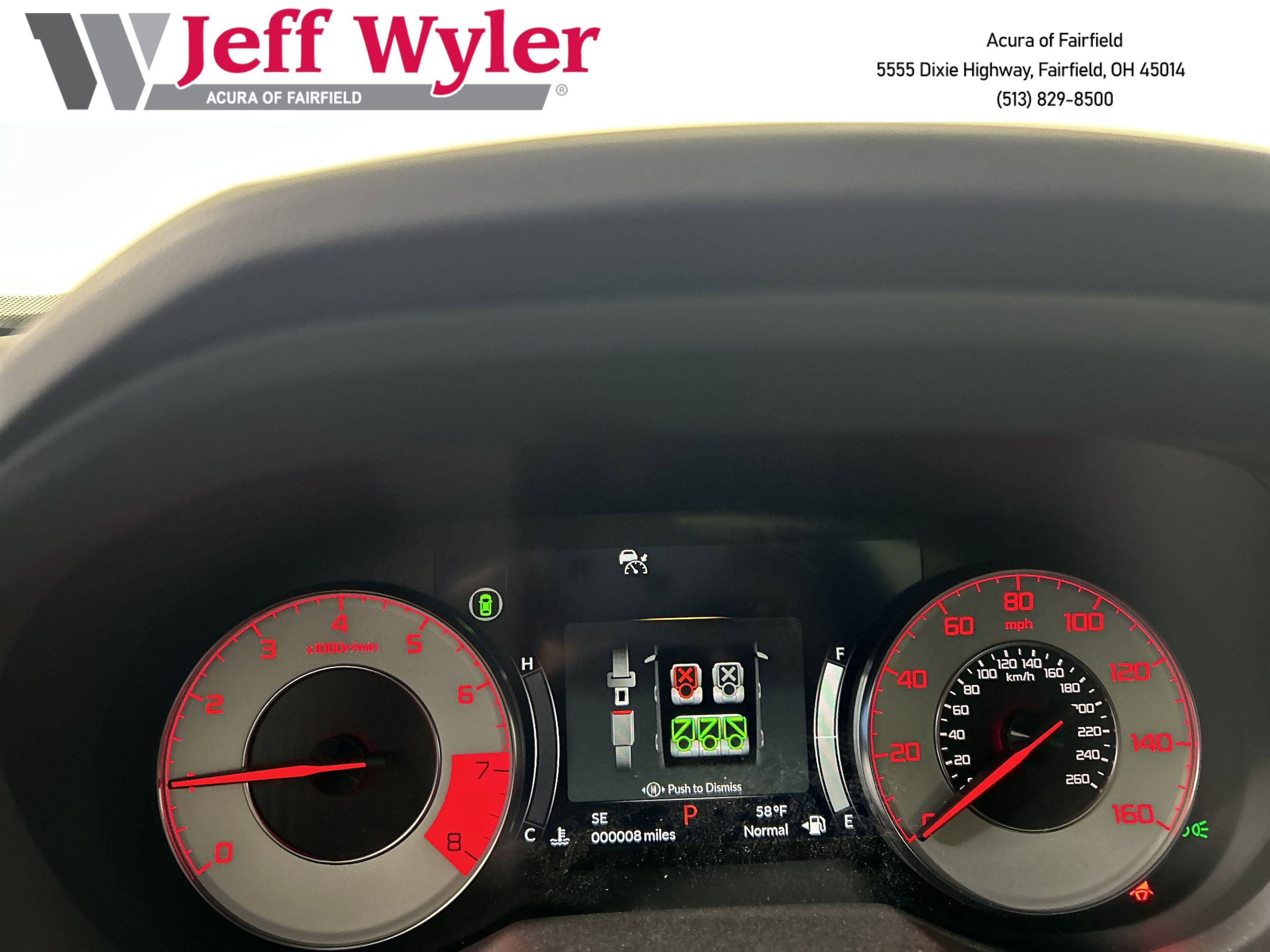 2025 Acura RDX A-Spec Package - Photo 28