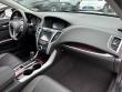 2017 Acura TLX Base Sedan