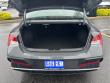 2024 Hyundai Elantra SEL Sedan
