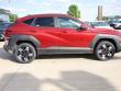 2025 Hyundai Kona SEL Convenience AWD SUV