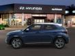 2026 Hyundai Venue SEL w/Two-Tone Roof SUV