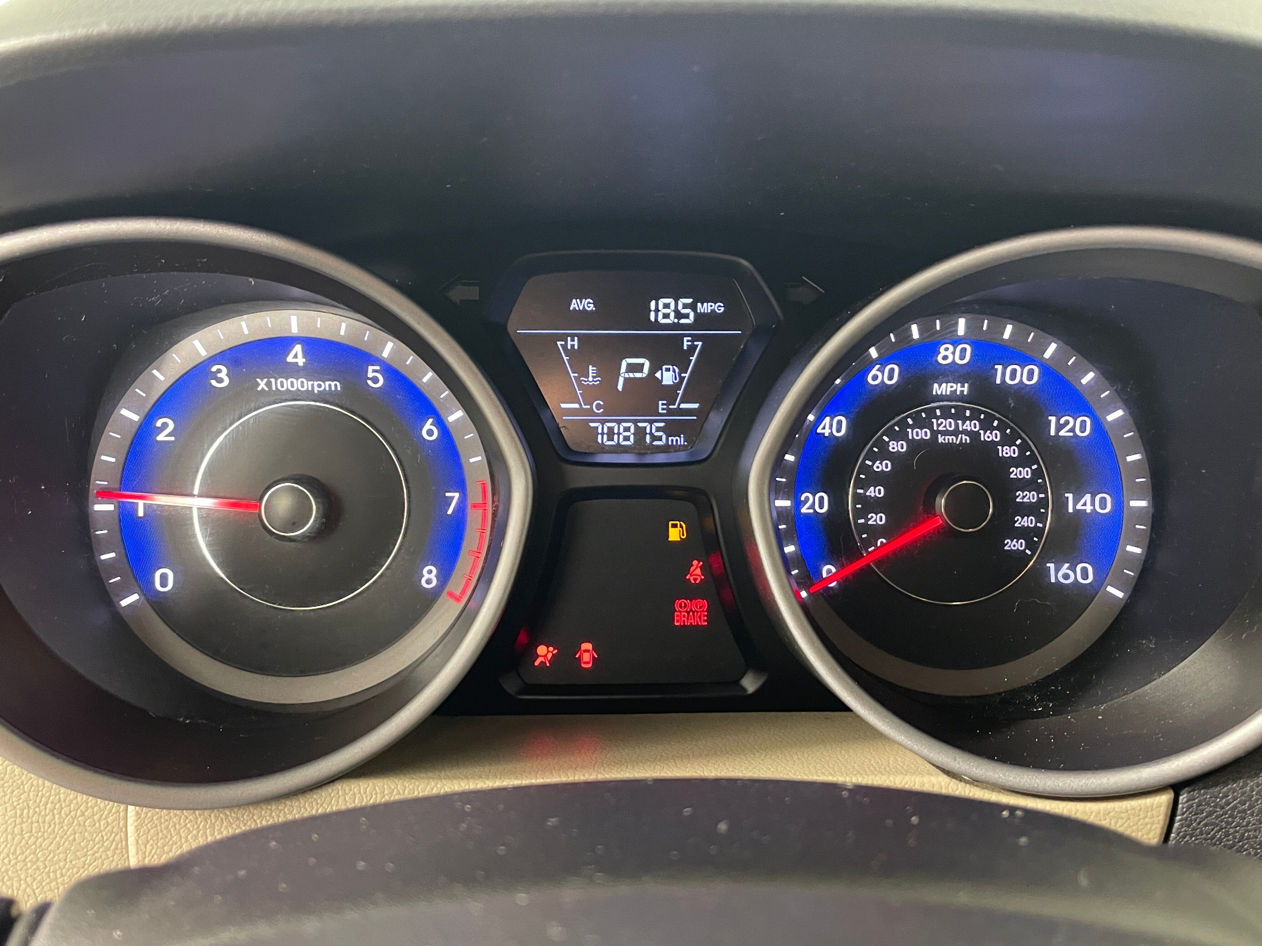 2016 Hyundai Elantra SE photo 5